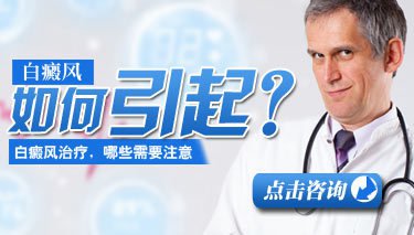 白癜风图片 白癜风病因图片